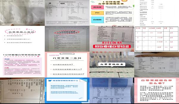 汕头市检查妇科哪里** - 汕头如何检查白带常规