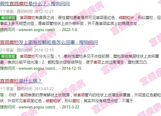 宫颈糜烂有颗粒状 - 汕头宫颈糜烂看到细颗粒状