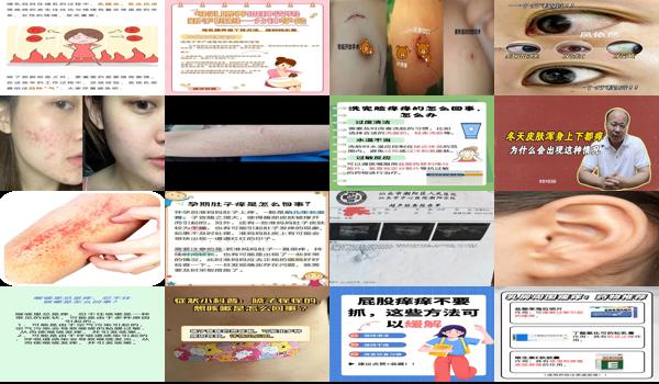 乳腺乳头痒怎么回事 - 汕头乳腺痒痒怎么回事