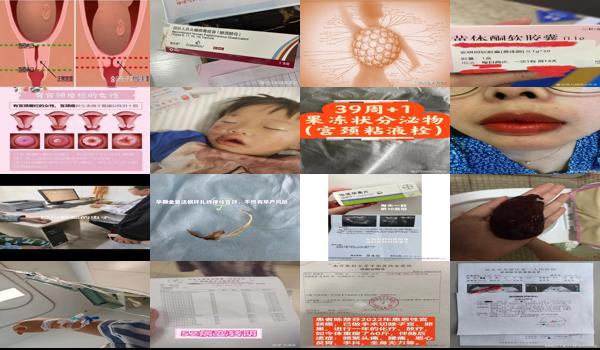 宫颈头有点痛怎么办 - 汕头宫颈有点疼感觉要掉出来了