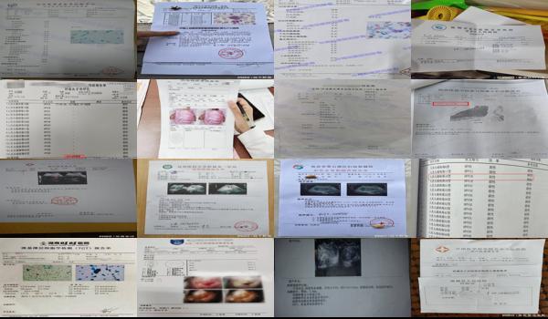 宫颈分泌物检验报告单 - 汕头宫颈分泌物检查报告单