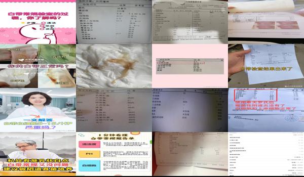 汕头有治疗白发的医院吗 - 汕头白带能检查