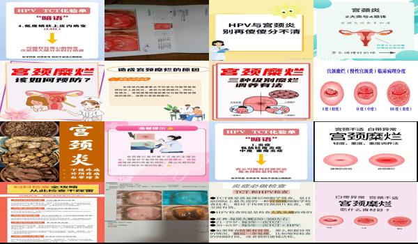 宫颈轻度炎症需要治疗吗? - 汕头宫颈轻度炎症严重吗