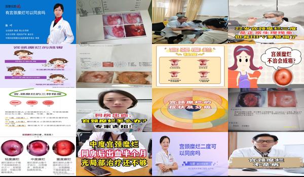 宫颈糜烂中度可以同房不 - 汕头宫颈糜烂中度可以同房吗