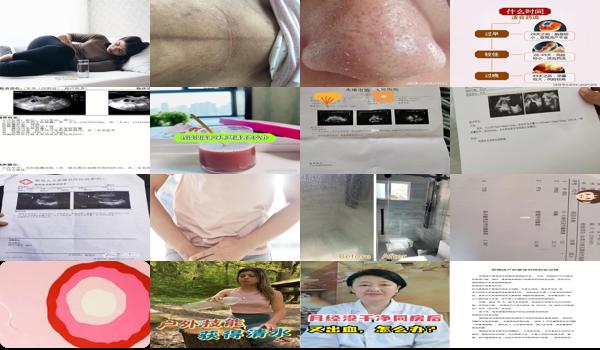 做药物流产没流干净怎么办 - 汕头药物流产没干净怎么办