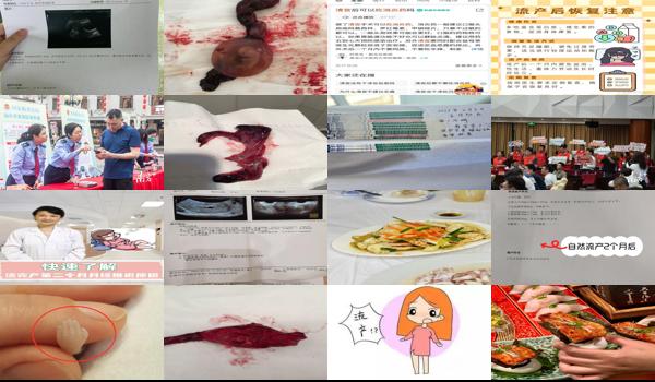 三个月了流产需要什么手续吗? - 汕头3个月后要流产怎么流