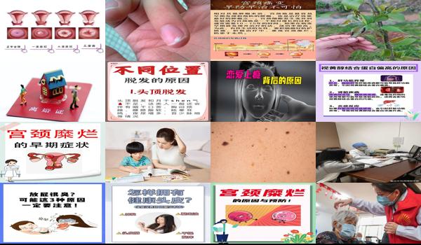 宫颈糜烂加出血怎么回事 - 汕头宫颈糜烂有流血现象是什么原因
