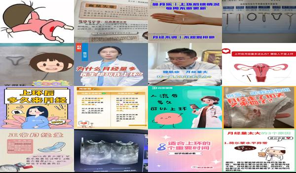 上环月经好多怎么办 - 汕头上环后月经太多怎么办
