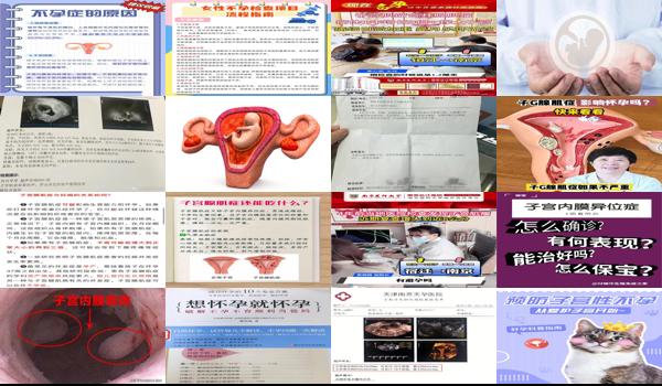 汕头治疗不孕不育 - 汕头子宫性不孕症怎样治
