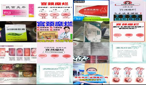 二度宫颈糜烂可以用什么药 - 汕头二度宫颈糜烂用什么药