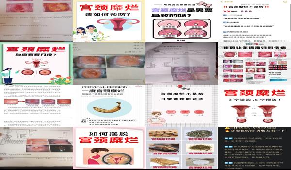 宫颈糜烂三度花多少钱 - 汕头宫颈糜烂3度多少钱