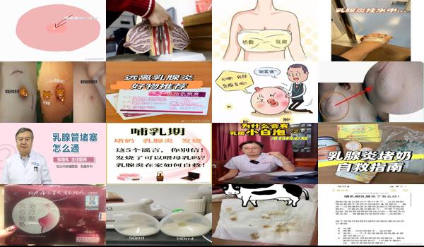 乳腺汕头哪个医院比较* - 汕头乳腺都塞