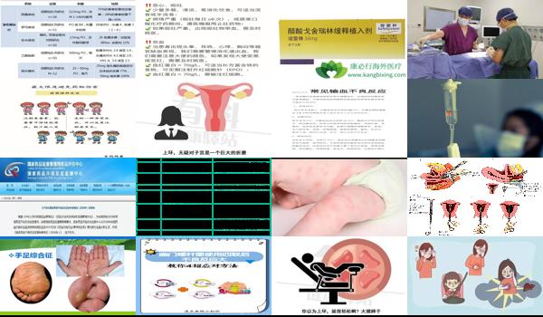 上环 女 - 汕头女性上环后有哪些不良反应