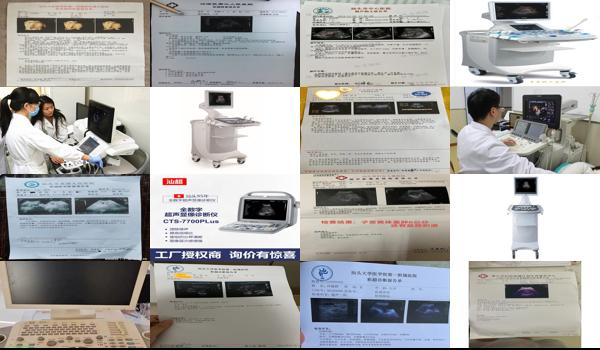 汕头彩超价格表 - 汕头检查彩超能检查出什么