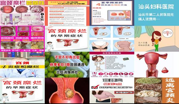 宫颈炎症怎么办? - 汕头宫颈炎症重怎么办