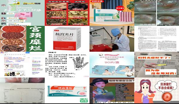 宫颈糜烂*医院治疗方案 - 汕头宫颈糜烂效果较好的方法是