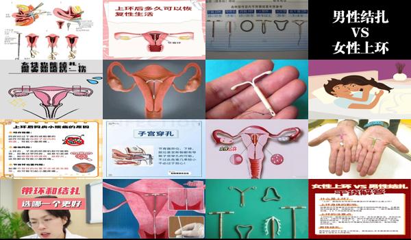 汕头上环需要多少钱 - 汕头上环和结扎哪个对女人好