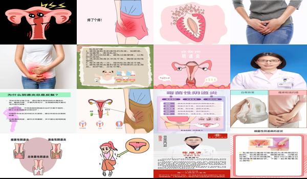 汕头看妇科病 - 汕头妇科炎症外阴痒