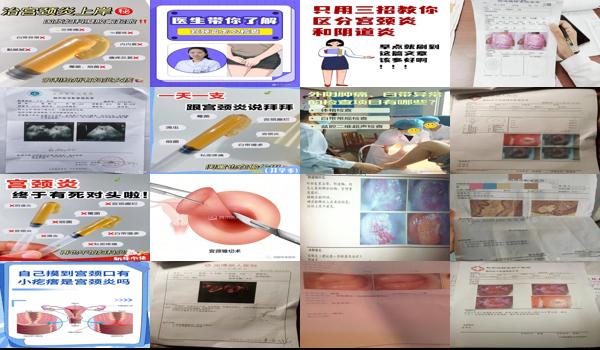 医院怎么检查宫颈炎 - 汕头怎么检查宫颈炎好了