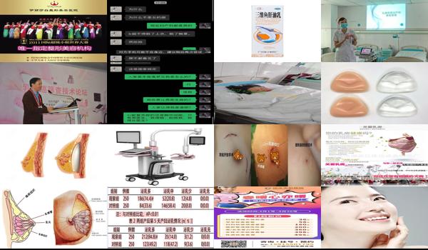 汕头副乳腺是什么医院 - 汕头副乳腺是什么