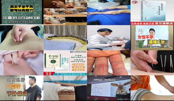 汕头针灸治不孕不育医院 - 汕头针灸治不孕不育