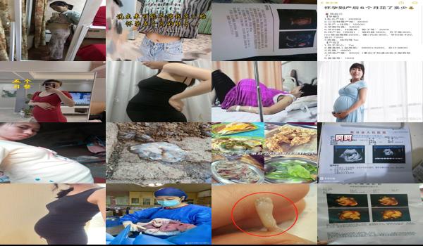 怀孕五个月可以做人流手术吗要多少钱 - 汕头怀孕五个月能做流产吗