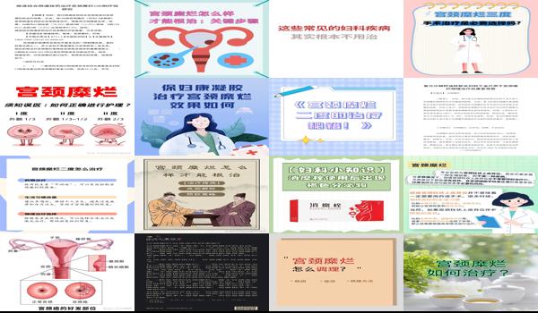 宫颈迷烂怎么办 - 汕头宫颈迷烂怎样治疗