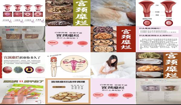 宫颈糜烂腰酸吗? - 汕头宫颈糜烂整天整夜都会腰酸吗