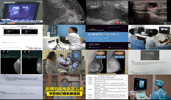 乳腺b超误差一般有多大 - 汕头乳腺b超误差正常范围