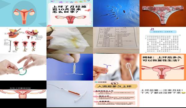 汕头生完宝宝后,没来月经可以上环吗 - 汕头生完宝宝后,没来月经可以上环吗