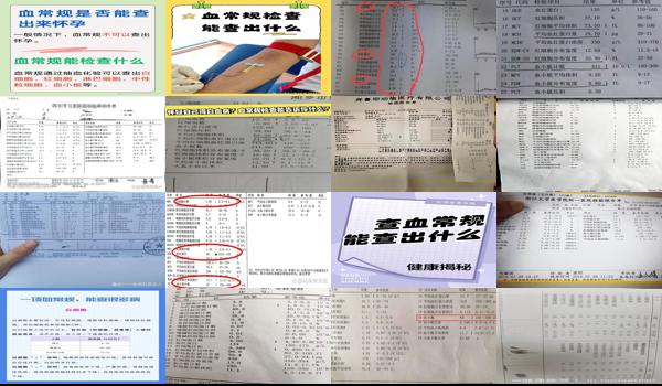 汕头中心医院血常规查一次多少钱? - 汕头检查血常规能查出什么