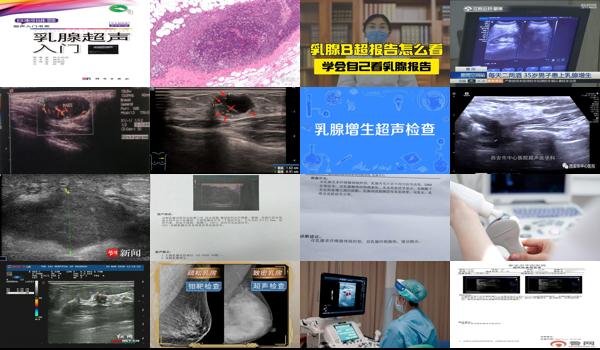 汕头b超乳腺纤维*多少钱 - 汕头b超乳腺纤维*