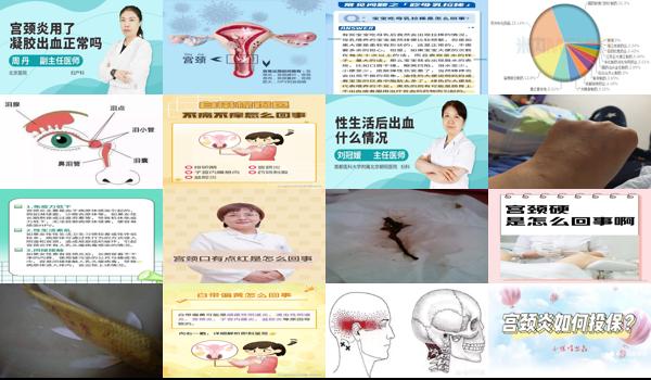 汕头哪个医院治疗宫颈*好 - 汕头宫颈炎是怎么回事的
