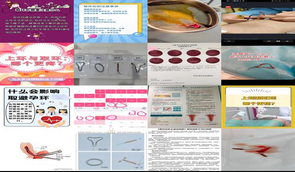 汕头取环后多久可以上环啊 - 汕头取环后多久可以上环