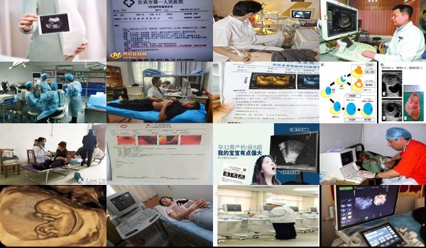 汕头b超能检查出宫颈炎吗多少钱 - 汕头b超能检查出宫颈炎吗