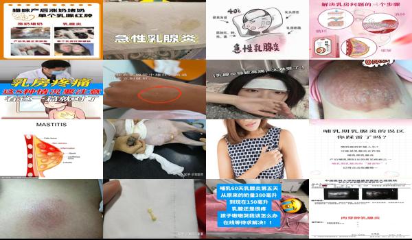 汕头乳腺发炎*医院 - 汕头乳腺发炎.