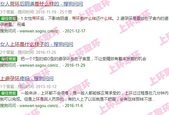 汕头哪家医院上环比较好 - 汕头上环是什么样子图片