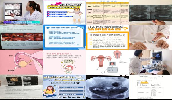 汕头检查输卵管什么时候*合适呢 - 汕头检查输卵管什么时候*合适