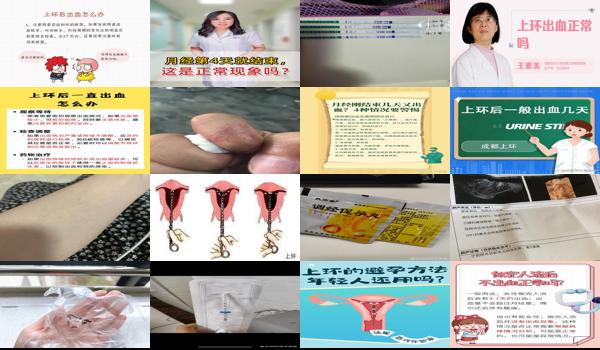 上环之后恶露要多久才干净 - 汕头上环过后出血几天正常的吗