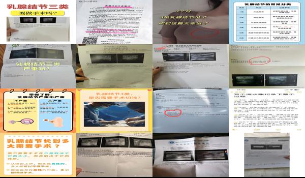 3类乳腺结节用手术吗 - 汕头乳腺结节3类需要手术吗