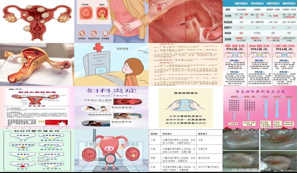 汕头妇科 - 汕头阴道炎宫颈炎会导致不孕吗