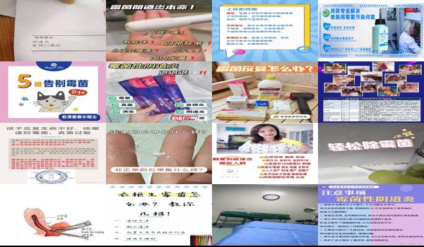 上环后得了霉菌怎么办 - 汕头上环引起的霉菌怎么办