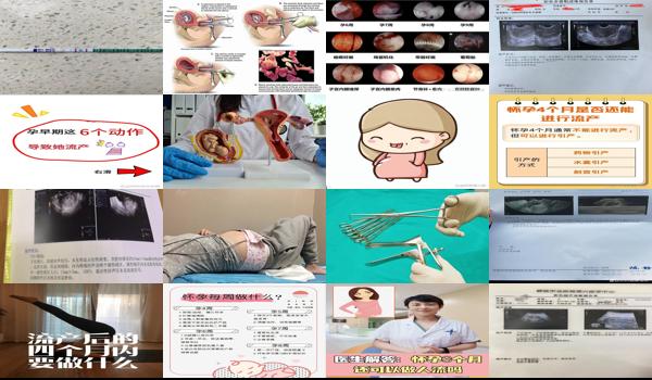 怀孕四周可以做人流 - 汕头怀孕4周能做流产吗