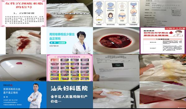 汕头妇科检查后有少量出血能同房吗 - 汕头妇科检查后有少量出血