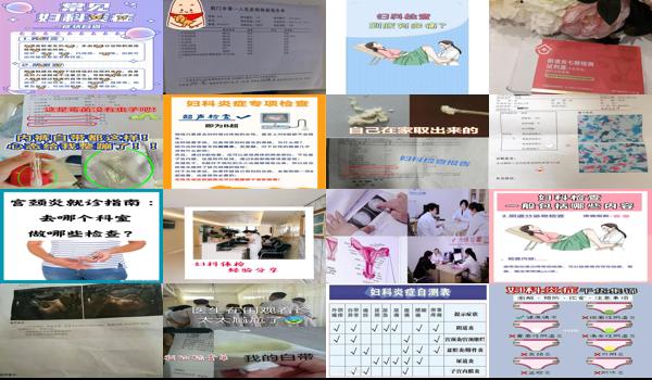 查妇科去汕头哪个医院 - 汕头妇科炎症怎么检查出来